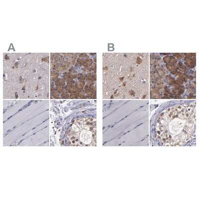 Immunohistochemistry-Paraffin: CARS Antibody [NBP1-86623]