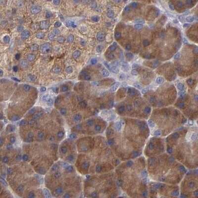 Immunohistochemistry-Paraffin: CARS Antibody [NBP1-86623]