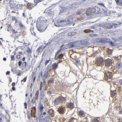 Immunohistochemistry-Paraffin: CARS Antibody [NBP1-86623]