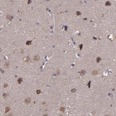 Immunohistochemistry-Paraffin: CARS Antibody [NBP1-86624]