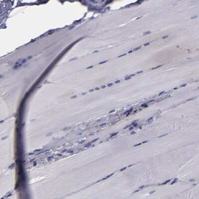 Immunohistochemistry-Paraffin: CARS Antibody [NBP1-86624]