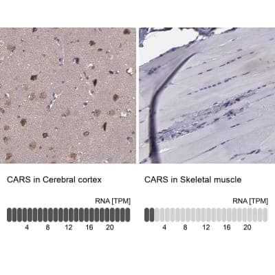 Immunohistochemistry-Paraffin: CARS Antibody [NBP1-86624]