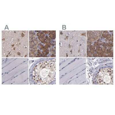 Immunohistochemistry-Paraffin: CARS Antibody [NBP1-86624]