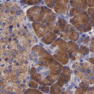 Immunohistochemistry-Paraffin: CARS Antibody [NBP1-86624]