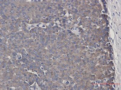 Immunohistochemistry-Paraffin: CARS Antibody (S01-7D4) [NBP3-19844]