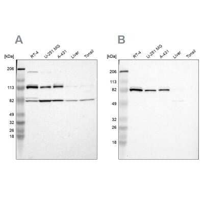 Western Blot: CARS Antibody [NBP1-86623]