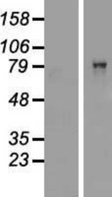 Western Blot: CARS Overexpression Lysate [NBP2-05572]