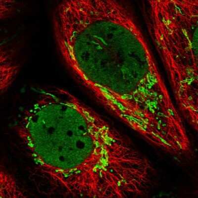 Immunocytochemistry/ Immunofluorescence: CARS2 Antibody [NBP2-32597]