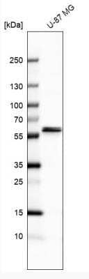 Western Blot: CARS2 Antibody [NBP2-32597]