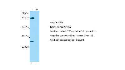 Western Blot: CARS2 Antibody [NBP2-82990]