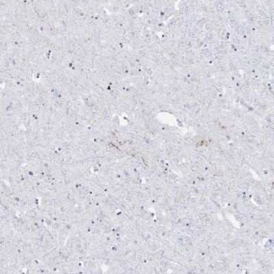 Immunohistochemistry-Paraffin: CART/CARTPT Antibody [NBP1-91749]