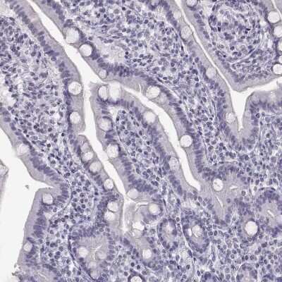 Immunohistochemistry-Paraffin: CART/CARTPT Antibody [NBP1-91749]