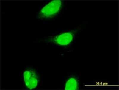 Immunocytochemistry/ Immunofluorescence: CART1 Antibody (2A10) [H00008092-M02]