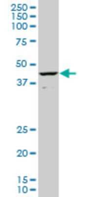 Western Blot: CART1 Antibody (2A10) [H00008092-M02]