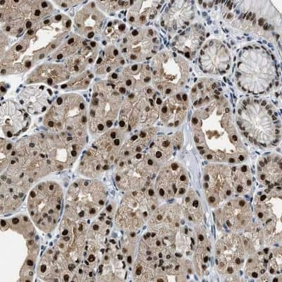 Immunohistochemistry: CART1 Antibody [NBP1-88190]