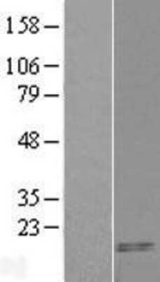 Western Blot: CART/CARTPT Overexpression Lysate [NBL1-08700]