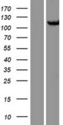 Western Blot: CSE1L/CAS/Exportin-2 Overexpression Lysate [NBP2-10972]