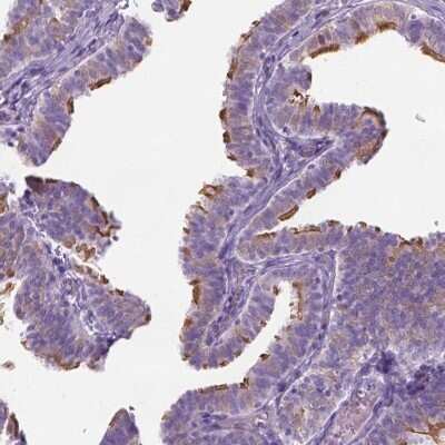 Immunohistochemistry-Paraffin: CASC1 Antibody [NBP1-83810]