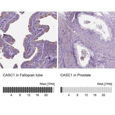 Immunohistochemistry-Paraffin: CASC1 Antibody [NBP1-83810]