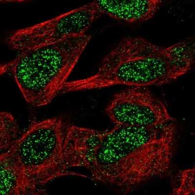 Immunocytochemistry/ Immunofluorescence: CASC10 Antibody [NBP2-38043]