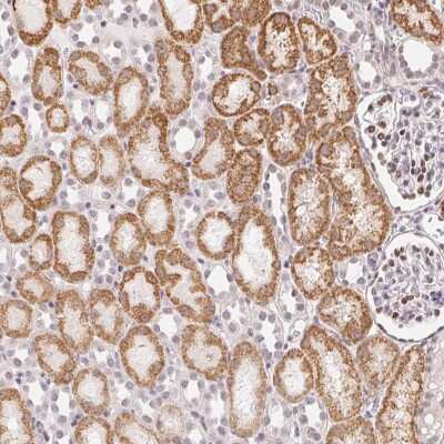 Immunohistochemistry-Paraffin: CASC10 Antibody [NBP2-38043]