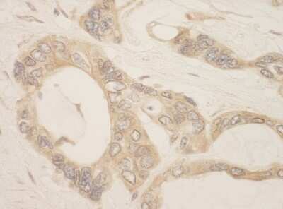 Immunohistochemistry: CASC3 Antibody [NBP1-30321]