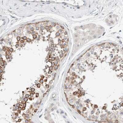 Immunohistochemistry-Paraffin: CASC3 Antibody [NBP1-88515]