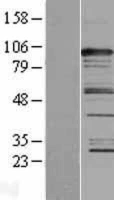 Western Blot: CASC3 Overexpression Lysate [NBL1-08701]