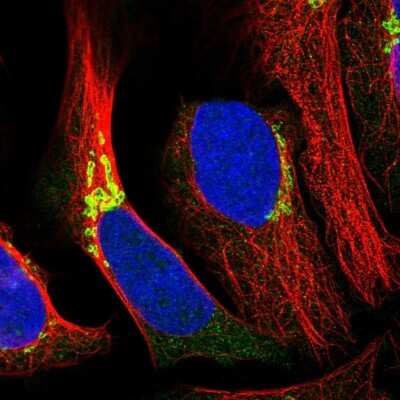 Immunocytochemistry/ Immunofluorescence: CASC4 Antibody [NBP2-30492]