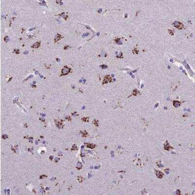 Immunohistochemistry: CASC4 Antibody [NBP2-30492]