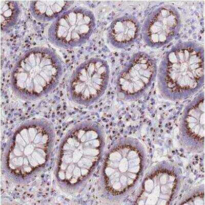 Immunohistochemistry: CASC4 Antibody [NBP2-30507]