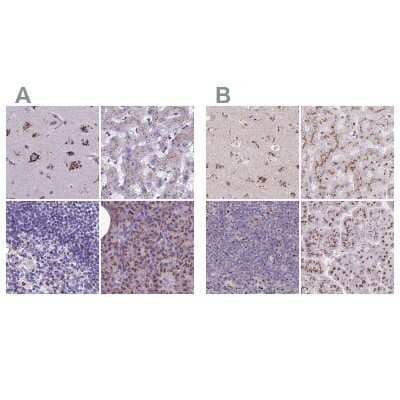Immunohistochemistry-Paraffin: CASC4 Antibody [NBP2-30492]
