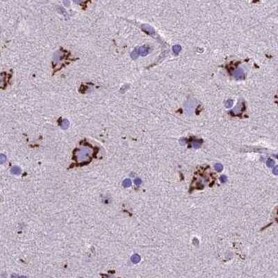 Immunohistochemistry-Paraffin: CASC4 Antibody [NBP2-30492]