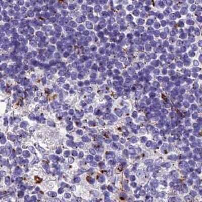 Immunohistochemistry-Paraffin: CASC4 Antibody [NBP2-30492]