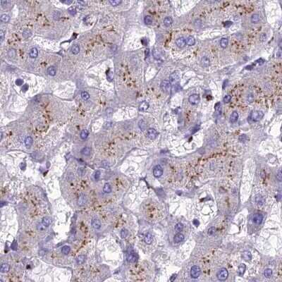 Immunohistochemistry-Paraffin: CASC4 Antibody [NBP2-30492]