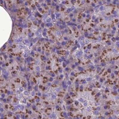 Immunohistochemistry-Paraffin: CASC4 Antibody [NBP2-30492]