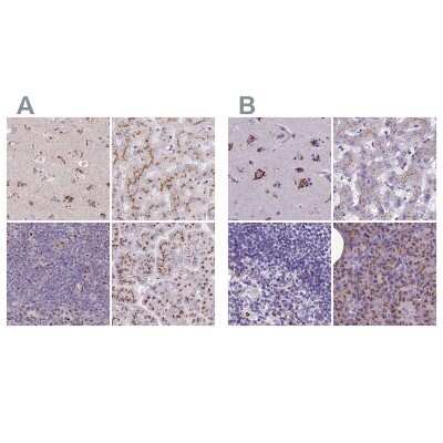 Immunohistochemistry-Paraffin: CASC4 Antibody [NBP2-30507]