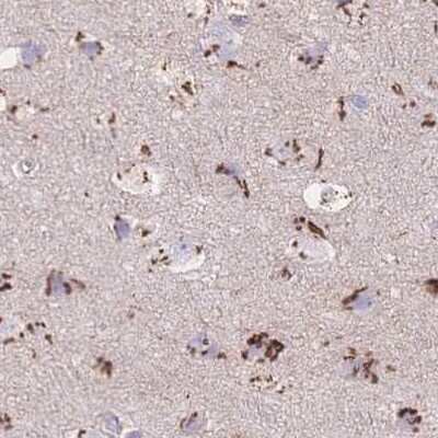 Immunohistochemistry-Paraffin: CASC4 Antibody [NBP2-30507]