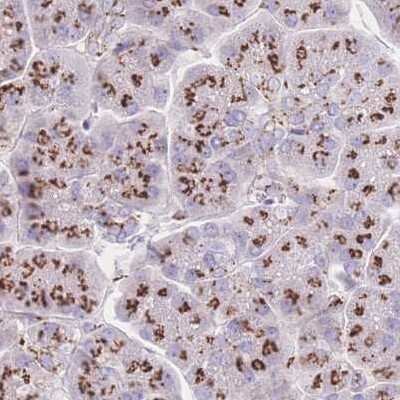 Immunohistochemistry-Paraffin: CASC4 Antibody [NBP2-30507]