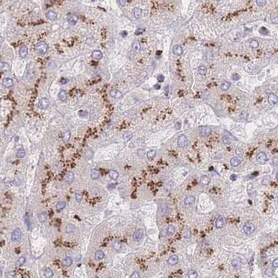 Immunohistochemistry-Paraffin: CASC4 Antibody [NBP2-30507]