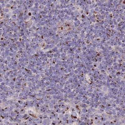 Immunohistochemistry-Paraffin: CASC4 Antibody [NBP2-30507]