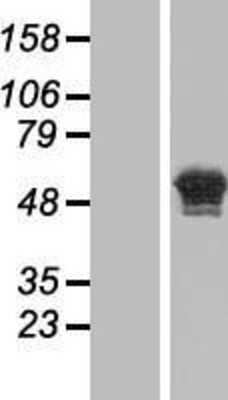 Western Blot: CASC4 Overexpression Lysate [NBP2-05006]