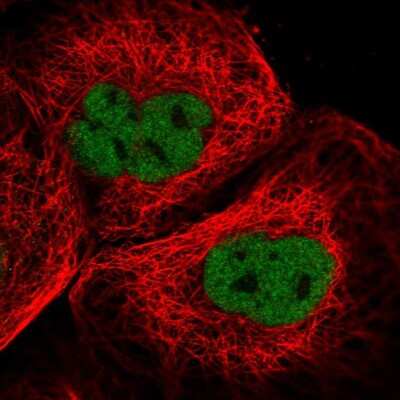 Immunocytochemistry/ Immunofluorescence: CASC5 Antibody [NBP1-89223]