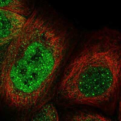 Immunocytochemistry/ Immunofluorescence: CASC5 Antibody [NBP2-56821]