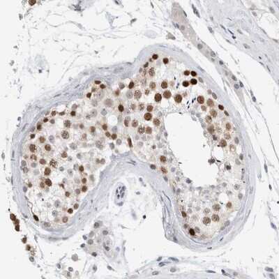 Immunohistochemistry-Paraffin: CASC5 Antibody [NBP1-89223]