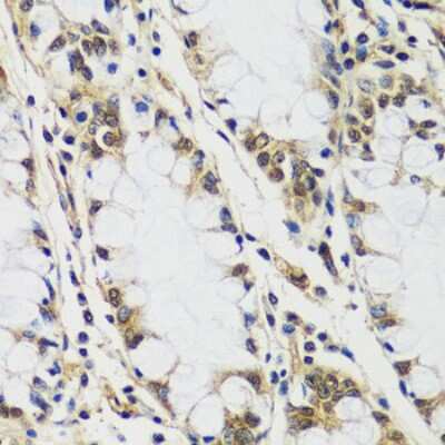 Immunohistochemistry-Paraffin: CASC5 Antibody - Azide and BSA Free [NBP2-92855]