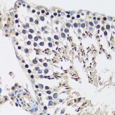 Immunohistochemistry-Paraffin: CASC5 Antibody - Azide and BSA Free [NBP2-92855]