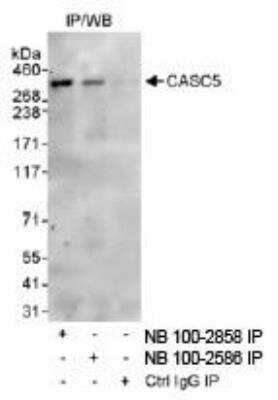 Immunoprecipitation: CASC5 Antibody [NB100-2585]