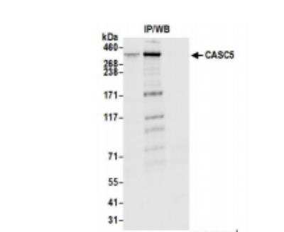 Immunoprecipitation: CASC5 Antibody [NB100-2586]