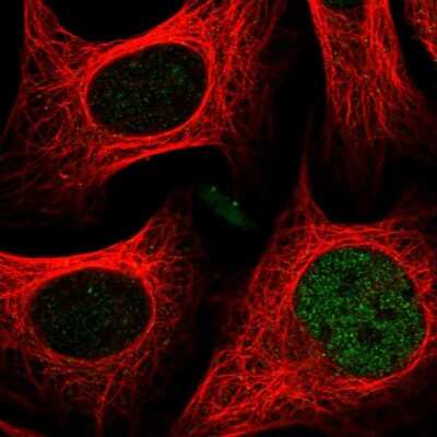 Immunocytochemistry/ Immunofluorescence: CASD1 Antibody [NBP1-91750]